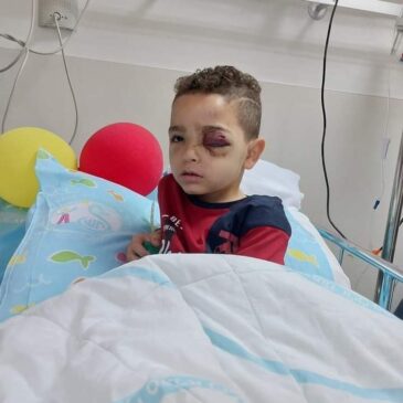 Un niño palestino de 5 años alcanzado en el ojo ayer por una bala de goma israelí.